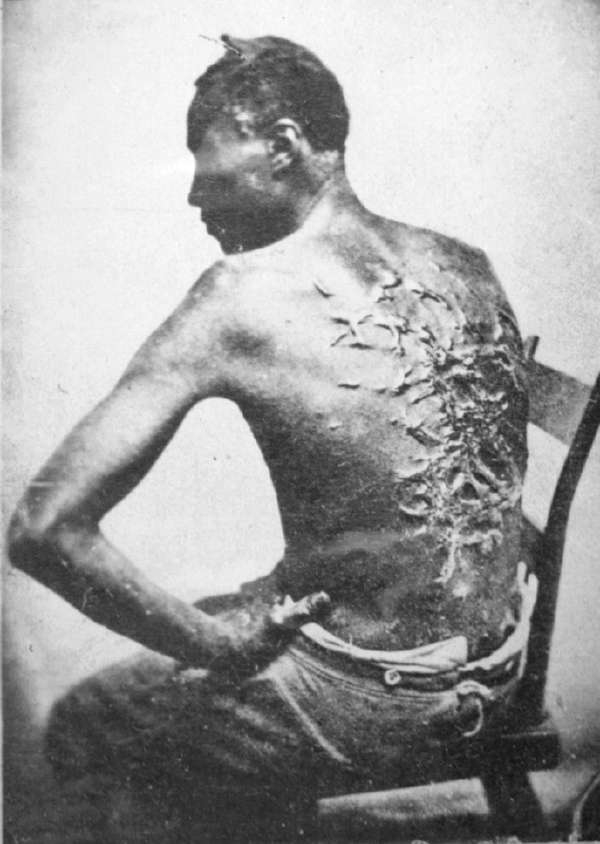 Overseer Artayou Carrier Whipped Me. I was Two Months in Bed Sore from the Whipping. My Master Come After I Was Whipped; He Discharged the Overseer.